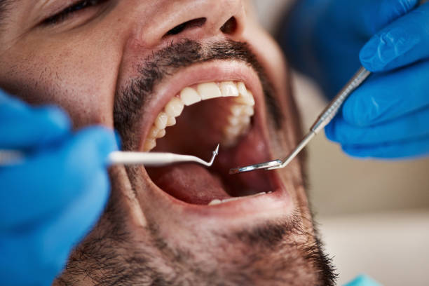Best Emergency Dental Extractions in Mounds, OK